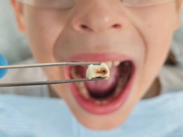 Best Emergency Cosmetic Dentistry in Omaha, TX